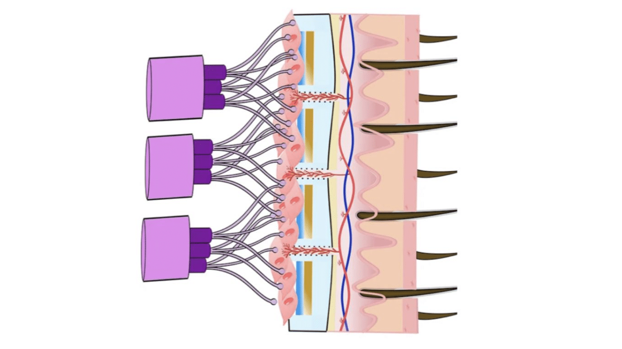 implant-restores-paralyzed-limbs